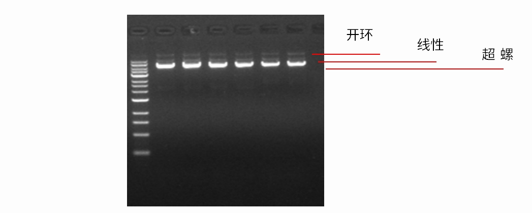 案例分享 | 质粒提取的常见问题和解决方案!