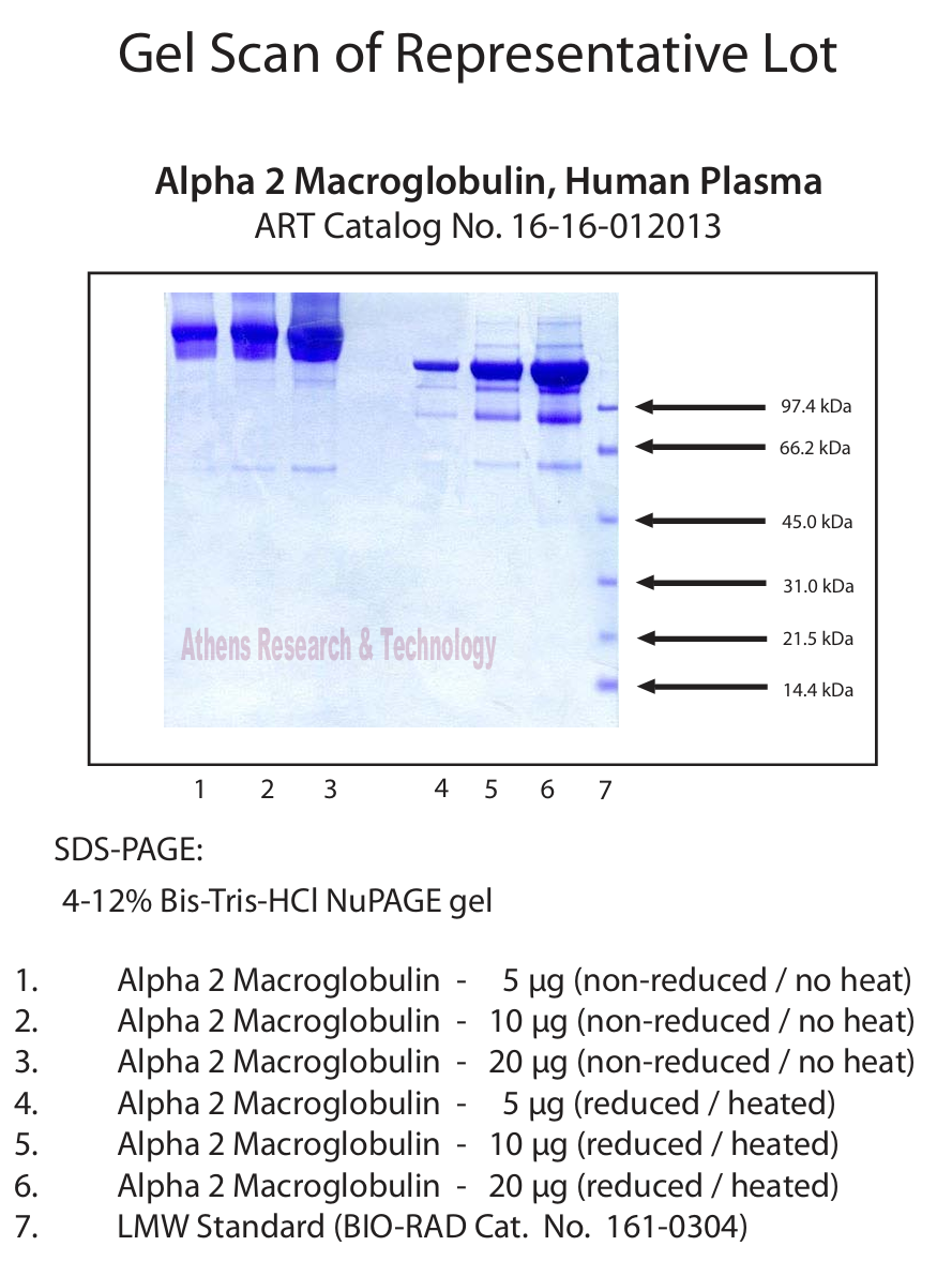 α2-巨球蛋白(a2M) 人血浆