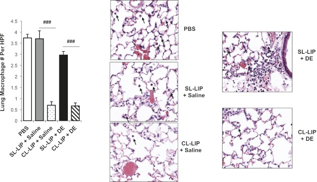 巨噬细胞清除小课堂 | 第三课:肺部