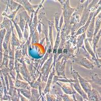 U-138MG人神经星形胶质母细胞瘤