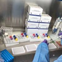 新城疫病毒抗体检测试剂盒