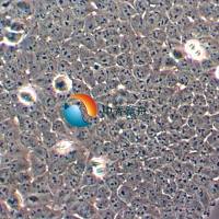 SACC-83人涎腺腺样囊性癌细胞