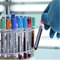 手动生化检测实验