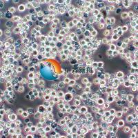 NOMO-1人白血病细胞