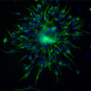 稳转株筛选与鉴定