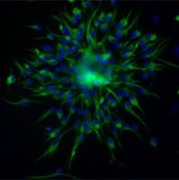 稳转株筛选与鉴定