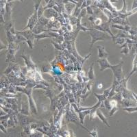 HCC1395人乳腺癌细胞