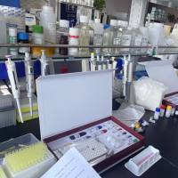 Hepatitis B Virus(HBV)乙型肝炎病毒G型探针法荧光定量PCR试剂盒