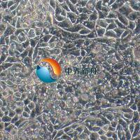 Caov-4人卵巢癌细胞