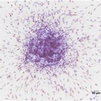 干细胞诱导分化