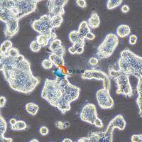 SNU-719人胃癌细胞