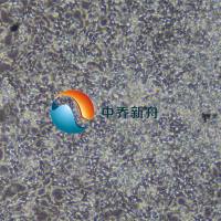 KP-N-NS人肾上腺神经母细胞瘤细胞(脑转移)