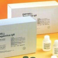 禽流感H7病毒抗体检测试剂盒