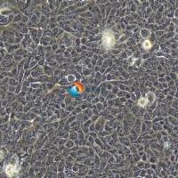 JIMT-1人乳腺癌细胞