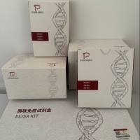 Hepatitis B Virus(HBV)乙型肝炎病毒E型探针法荧光定量PCR试剂盒