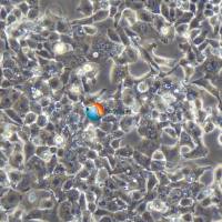 NCI-H727人支气管良性肿瘤