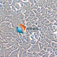 HCC4006人肺癌腺癌细胞