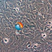 KYSE-410人食管鳞癌细胞