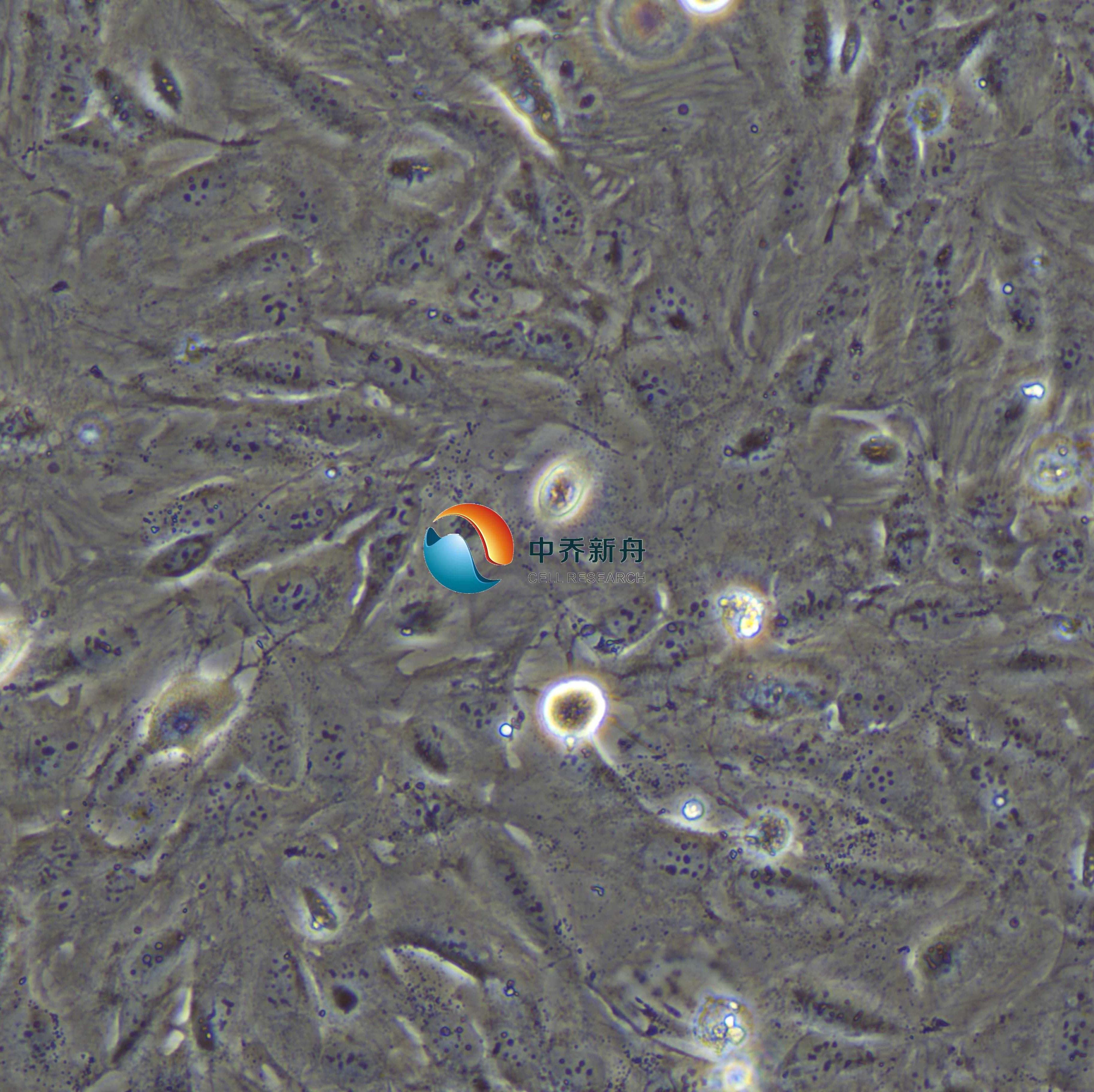 SNU-423 人肝癌细胞