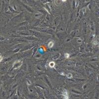 SNU-423 人肝癌细胞