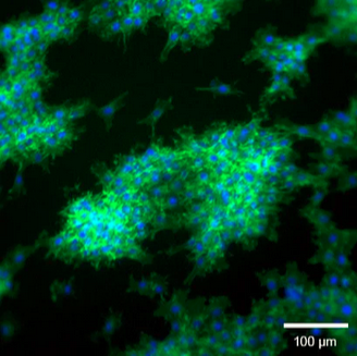 ibidi 3D 细胞培养微插件（Micro-Insert 3D）简介