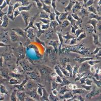 TOV21G人卵巢癌细胞