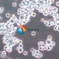 HUG1-N 人胃肾小管腺癌