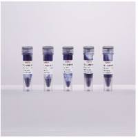 变性蛋白上样缓冲液(5×)