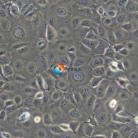 HCE-T人角膜上皮细胞