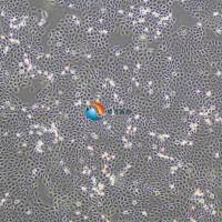 BPH-1人前列腺增生细胞