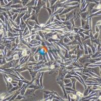 MEL270人脉络膜黑色素瘤细胞