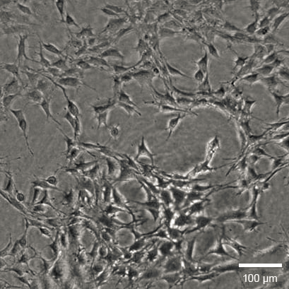 ibidi 3D 细胞培养微插件（Micro-Insert 3D）简介