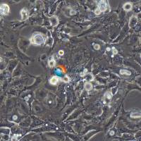 KNS-62人肺支气管鳞状细胞癌