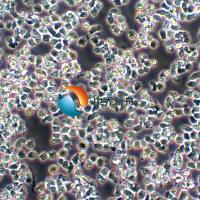 Z-138人套细胞淋巴瘤细胞