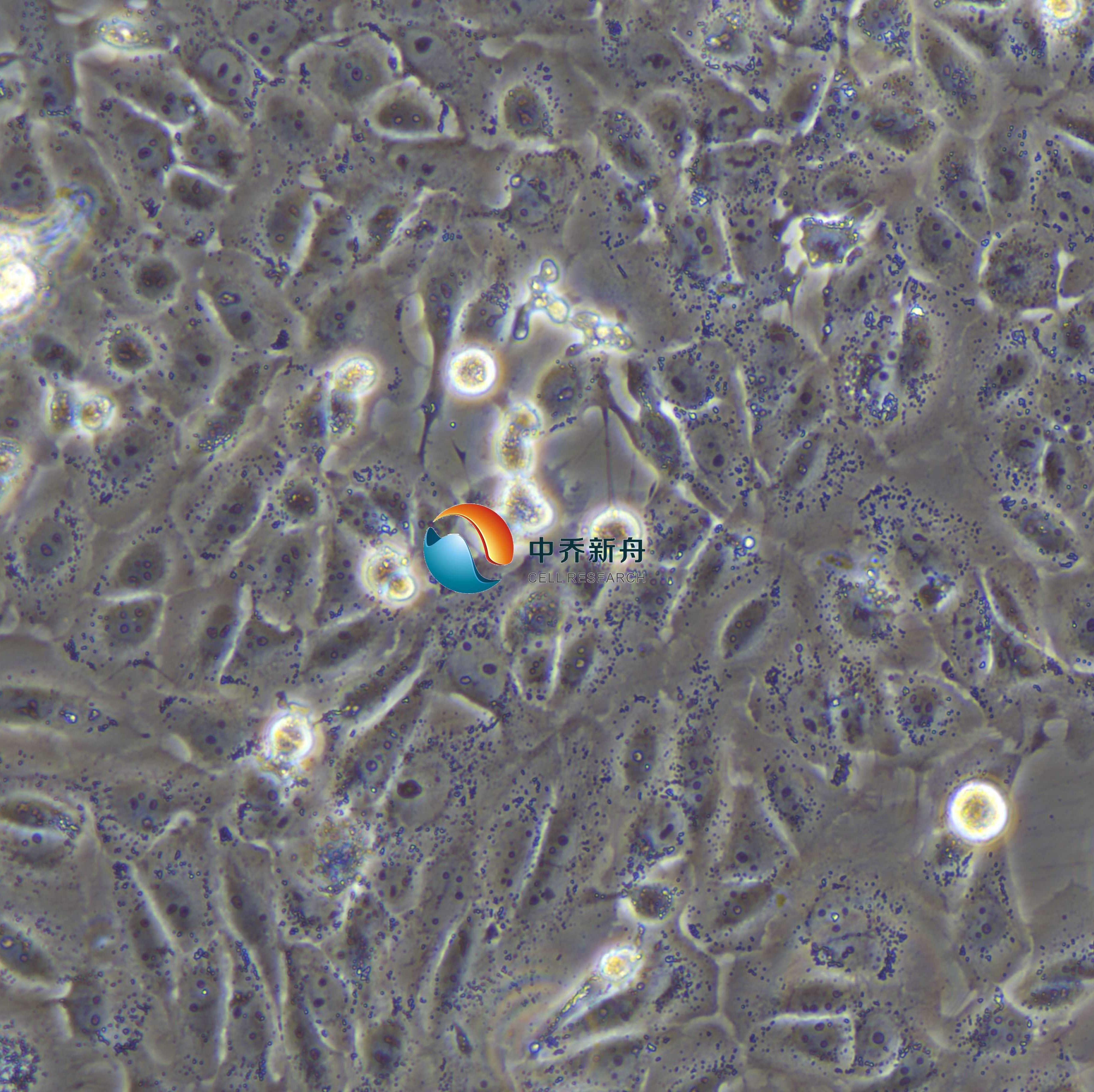 EPLC-272H人肺腺癌细胞