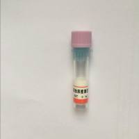 IHC kit 免疫组化试剂盒（抗兔）