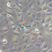 LCLC-103H人大细胞肺癌