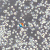 GM12878 人B淋巴细胞