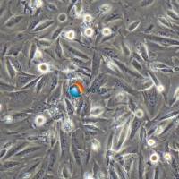 LOU-NH91人肺癌鳞癌细胞