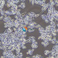 MNT-1人黑色素瘤细胞