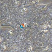 KYSE-510人食管鳞状细胞癌细胞