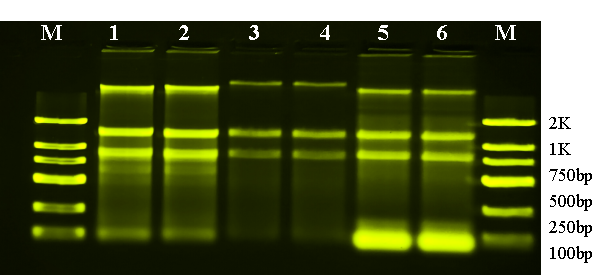 真菌DNA/RNA提取试剂（磁珠法）