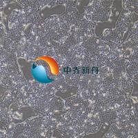 LCLC-97TM1人大细胞肺癌