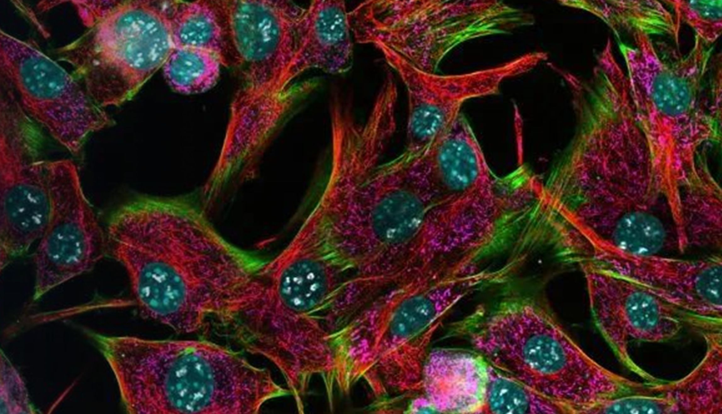 成像中心平台管理人员的得力工具——开创性显微镜性能监测器！