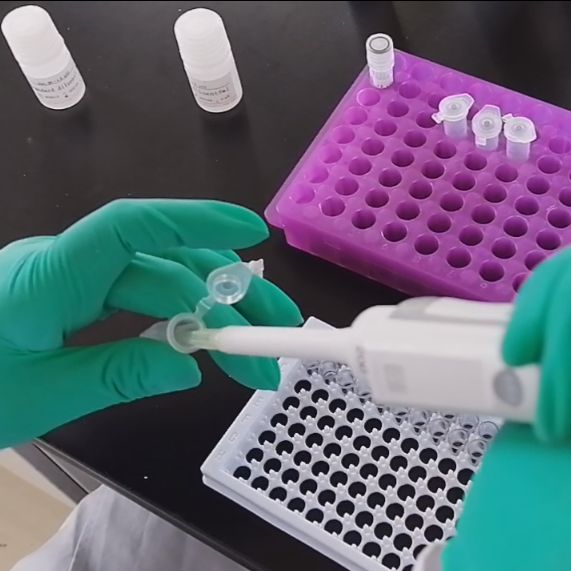 HRP标记一抗 /HRP-小鼠抗乙肝核心抗原