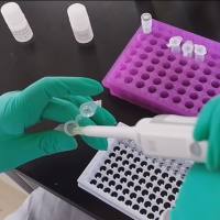 HRP标记一抗 /HRP-小鼠抗乙肝核心抗原