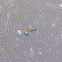 人视网膜色素上皮