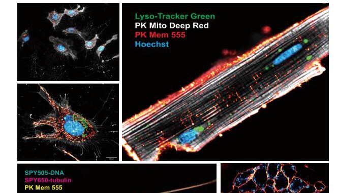 PKMEM™系列的细胞膜超分辨率探针应用于多种癌细胞和原代细胞的活细胞或固定细胞的超分辨成像