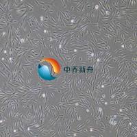 人冠状动脉平滑肌细胞