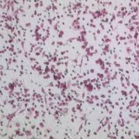 Transwell细胞侵袭